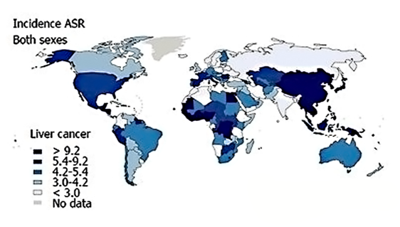Global incidence of hepatocellular carcinoma. Sourced from GLOBOCAN 2012.