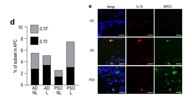 Fig1. mregDCs produce IL-15 and are more abundant in AD skin. (d) Proportion of IL15-producing cells in
      AD and PSO skin.