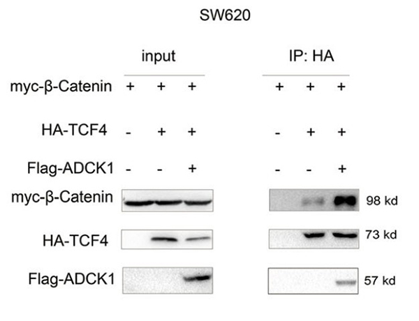 Fig3. Co-IP was performed to examine the effects of ADCK1 overexpression on the interaction between β-catenin and
        TCF4 in SW620 cells.
