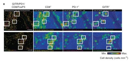 Fig2. Representative CD8, PD-1, GITR and FoxP3 multiplex immunofluorescence imaging (excluding PanCK,
  CD3 and DAPI) and spatial distribution cell density heatmaps (cells mm–2) (CD8, PD-1 and GITR) of FFPE sections of
  primary HNSCC (excluded compartment) and matching lymph node metastases (LN mets) (20×).
