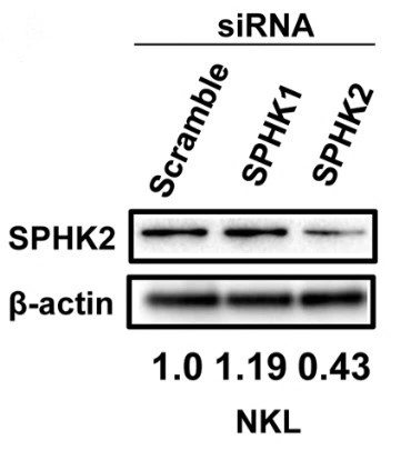 SPHK2-3.jpg
