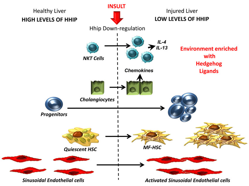 Differential Activity of Hedgehog Pathway in Healthy and Injured Livers.