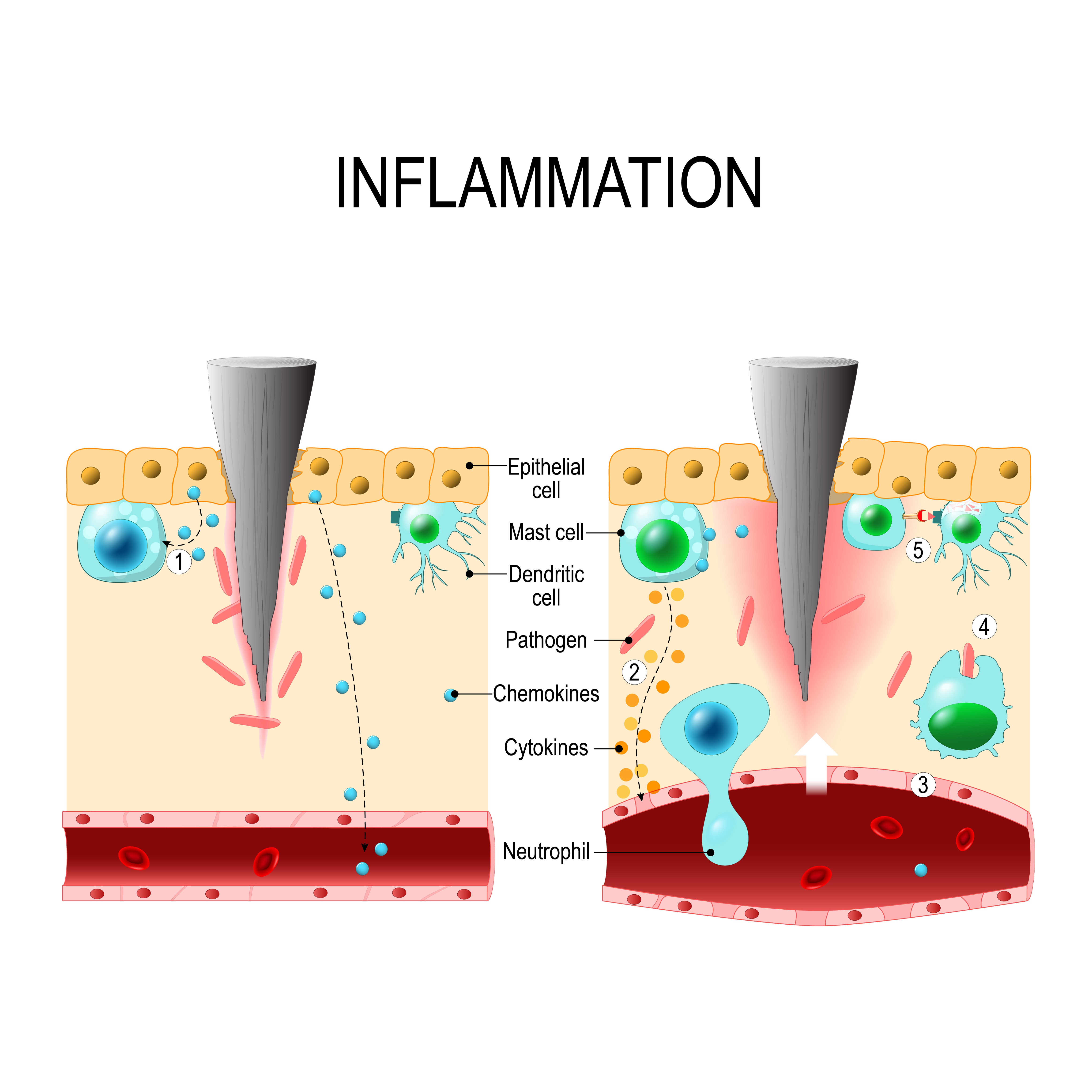 Inflammation - Creative BioMart 