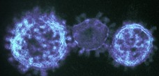 New Clue Was Found Regarding the New Coronavirus: Protein DPP4