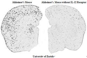 Nature: Fighting Alzheimer's Disease from the Perspective of Immune Transmitter