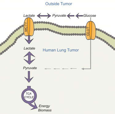 lactate metabolism in human lung tumors