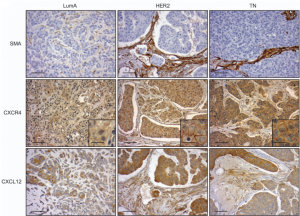  Representative views of smooth-muscle actin (SMA), CXCR4 and CXCL12 immunostaining (IHC) in PDX models derived from Luminal A (LumA, Left), HER2 (Middle) and Triple-Negative (TN, Right) breast cancers (BC).