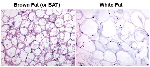 BAT and white fat