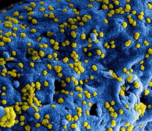 PNAS: New Study Shows that Remdesivir Prevents Coronavirus MERS-CoV Infection in Monkeys