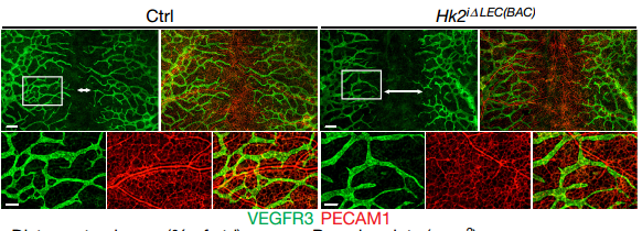 Fig2. HK2 knockout effect lymphangiogenesis.