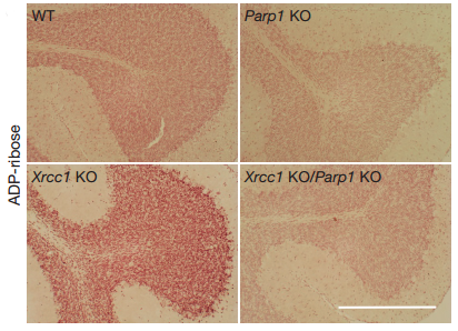 ADP-ribosylation levels measured by immunohistochemistry in cerebellar sections from WT mice or mice deleted of Xrcc1 and/or Parp1.