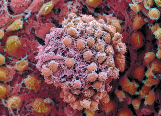 Policy Global standards for stem-cell research