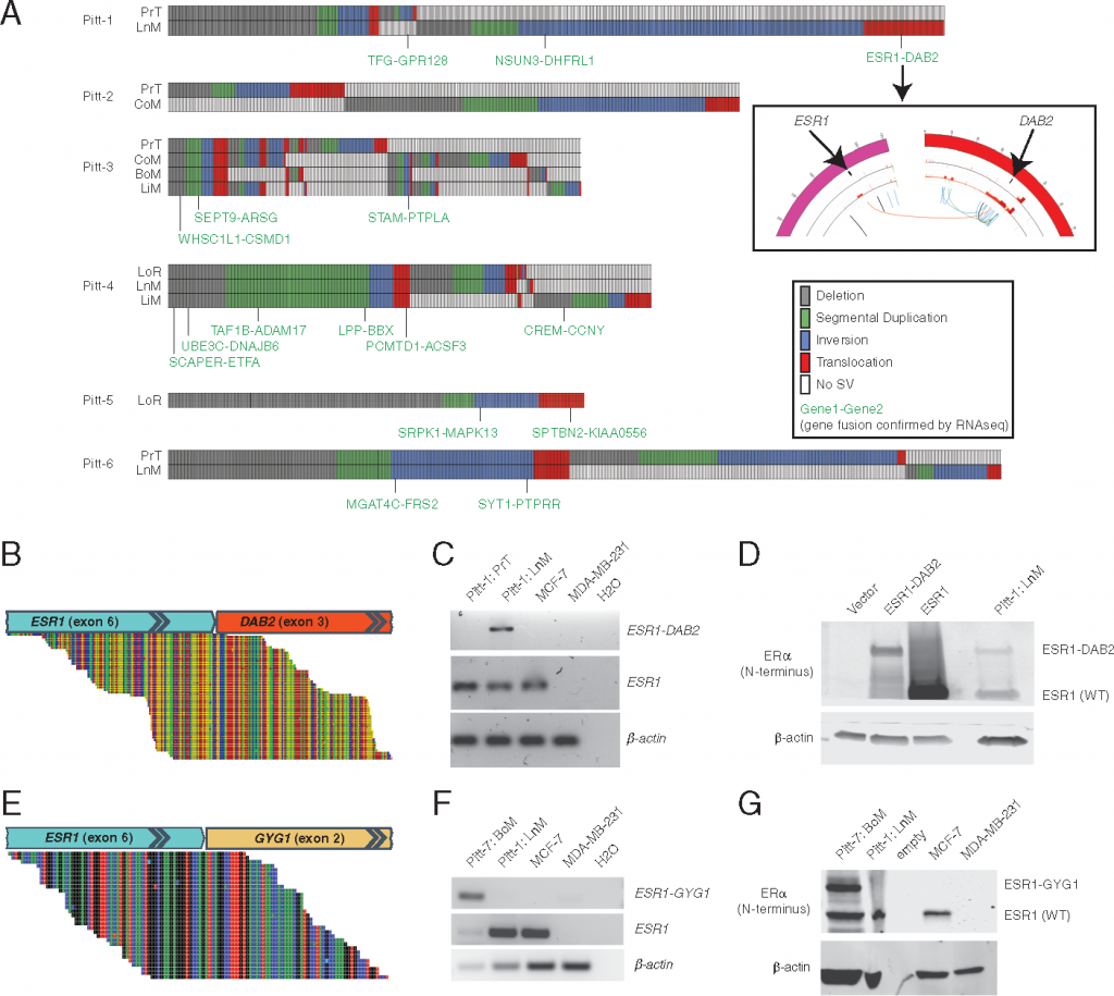 Recurrent hyperactive ESR1 fusion proteins in endocrine therapy-resistant breast cancer
