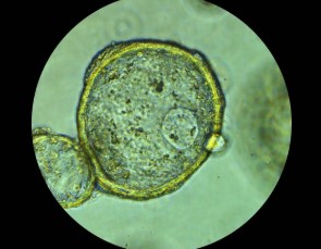 A WNT-free culture medium for head and neck tumor organoids accurately replicates tumor characteristics