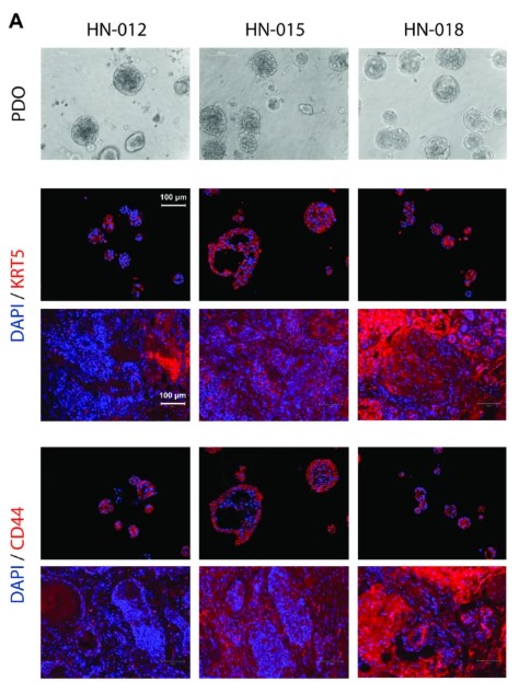 Fig2. Cellular Biological Characteristics of Patient-derived Organoid Models