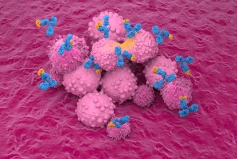 As a “Cousin” of CAR-T Cells, HIT Cell Therapy Shows Promise for Treating Solid Tumors