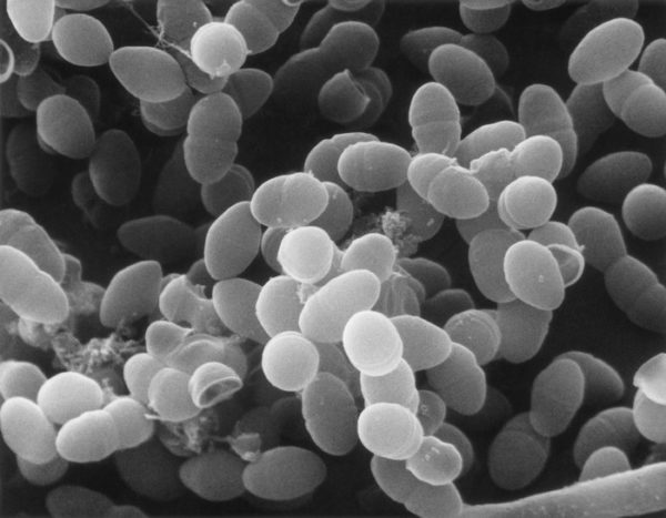 New Study Reveals Mechanism by Which Lactose Promotes Graft-versus-host Disease