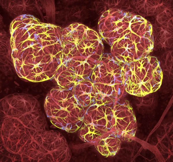 Nat Immunol: Revealing New Mechanisms of Increased Immunity Following Lung Infection