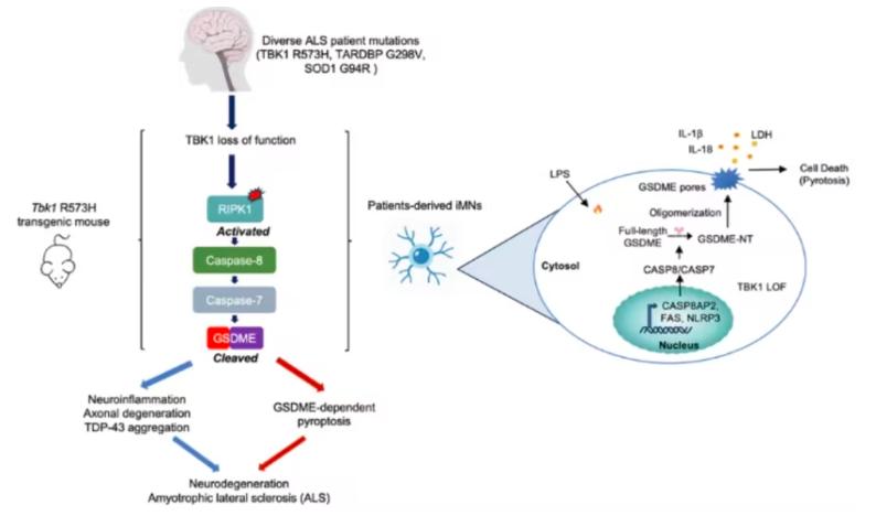 Fig 1. Proposed mechanism linking TBK1 dysfunction to GSDME-dependent pyroptosis and motor neuron degeneration across ALS genotypes.