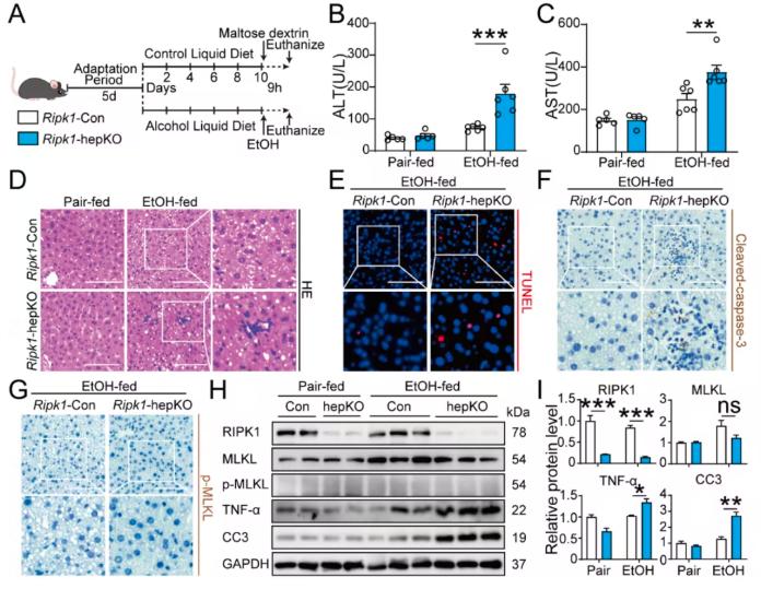 Fig 1. Hepatocyte RIPK1 deficiency exacerbates alcohol-induced liver injury.