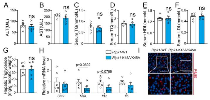 Fig 2. RIPK1 kinase inactivation does not significantly affect alcohol-induced liver injury.