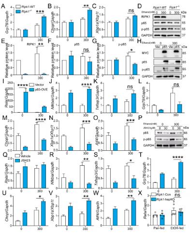 Fig 5. NF-&kappa;B/p65 signaling contributes to RIPK1-mediated regulation of ER stress.