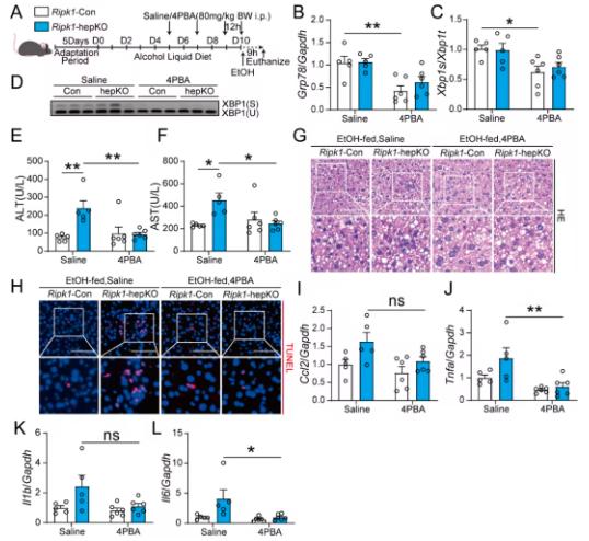 Fig 6. 4-PBA alleviates alcohol-induced liver injury and inflammation in RIPK1-deficient mice.