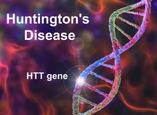 How the Language Gene FOXP2 Can Help Treat Huntington's Disease