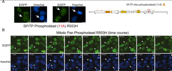 Fig3. Concerted function of FOXP2 phosphorylation sites in mitotic solubility