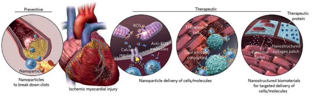 nanomedicine can treat heart disease