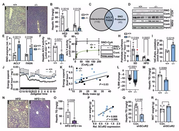 Fig1: Inhibition of lipid synthesis and enhancement of fat oxidation through S-nitrosylation; deletion or pharmacological inhibition of hepatic SCoR2 prevents steatosis.