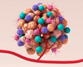 Microenvironmental Protein CTHRC1 Shown to Promote Colorectal Cancer Progression