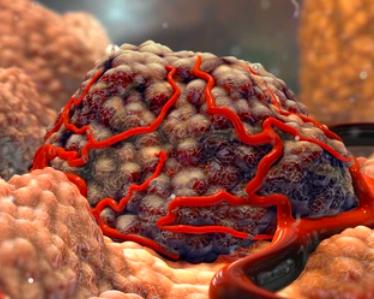 Protein AMPylation Enters the Tumor Suppression Network: SelO Emerges as a Potential New Target in Cancer Research