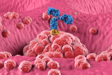Research Progress in CAR-T Cell Therapy