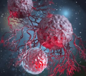 The “Lurkers” Behind Cancer Metastasis — Scientists Identify a Key Culprit in Breast Cancer Spread