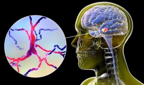 The Critical Regulatory Role of USP25 in Parkinson's Disease