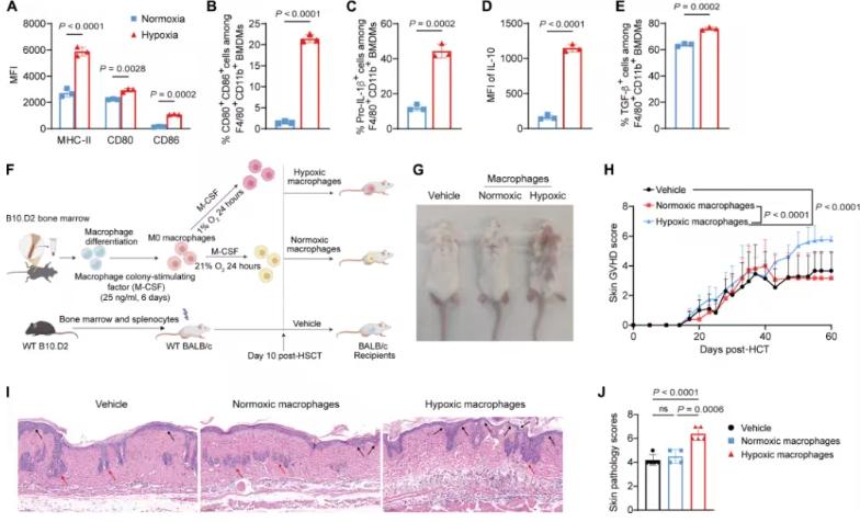 Fig 1. Hypoxia enhances macrophage pathogenic activity in cGVHD (Science Translational Medicine)