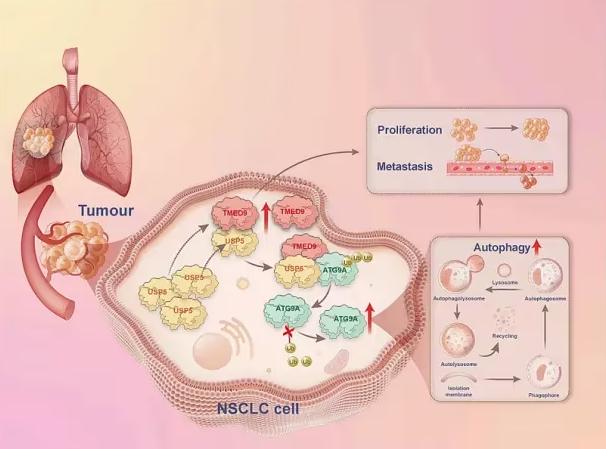 Fig 1. Schematic model showing how TMED9 regulates autophagy and malignant progression in NSCLC