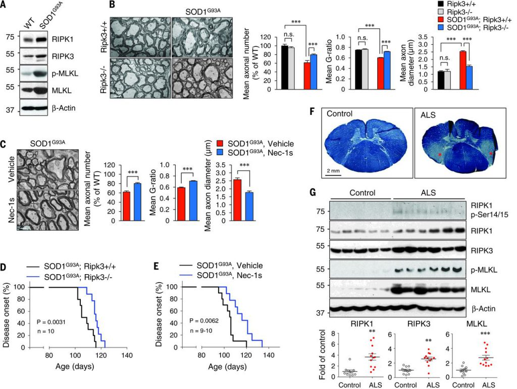 RIPK1- and RIPK3- mediated axonal pathology
