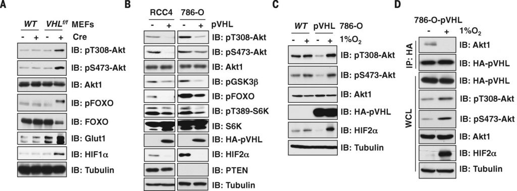 Fig. 1 pVHL suppresses Akt phosphorylation.