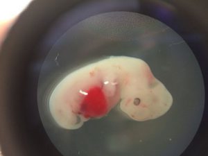 First-human-pig-embryos