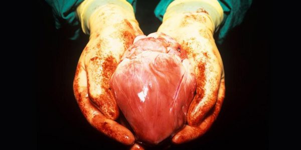Would you accept a pig heart