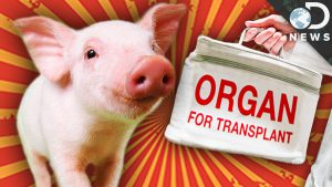 Pig's organ for transplant