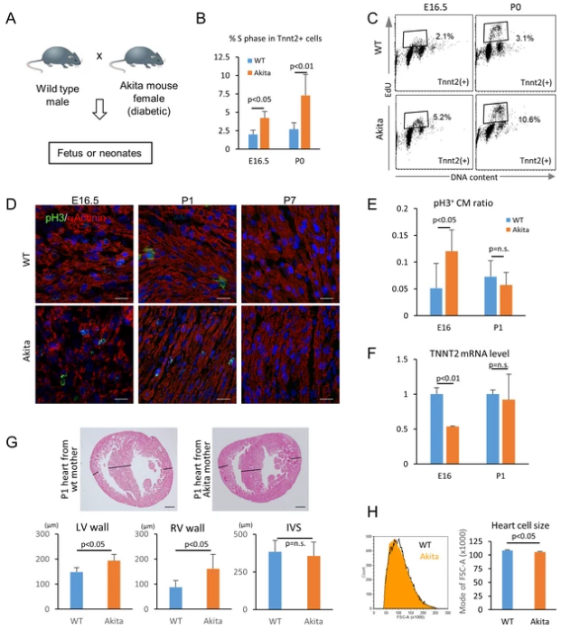 Hyperglycemia promotes the proliferation and inhibits the maturation of fetal cardiomyocytes in utero