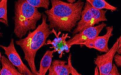 Chromatin and Nuclear Signaling