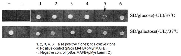 Screening of Positive Yeast Clones