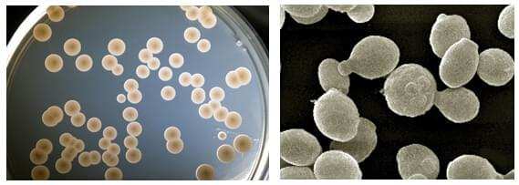 Pichia Glyco Protein Production