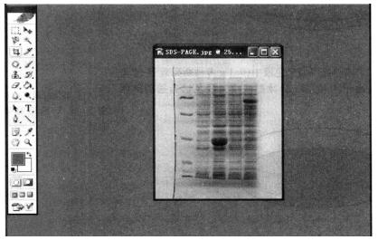 Principal and Protocol of Coomassie Brilliant Blue