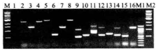 Principal and Protocol of Yeast One-hybrid Analysis