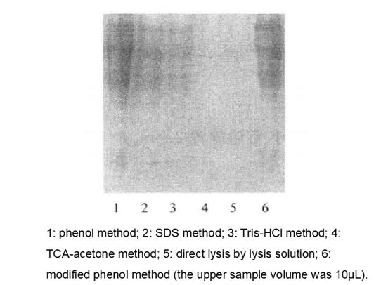 Principle and Protocol of the PRO Q Diamond Staining